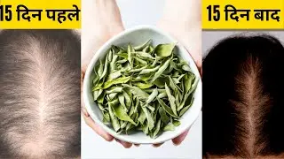 तेल लगाना भूल जाओगे 1Min लगालो कितने भी पतले कमजोर जड़ते बाल, 2बार मे नए बाल आए, curryleaves benefits