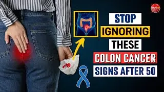 6 Most Ignored Colon Cancer Sign You Should Not Ignore