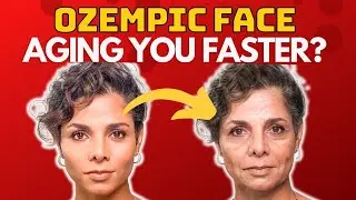 PREVENT OZEMPIC FACE FAT LOSS with these 3 simple FACE YOGA EXERCISES