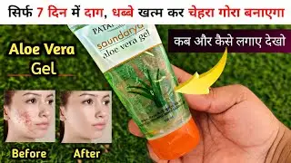 Aloe Vera For Face || Patanjali Saundarya Aloe Vera Gel Review || Aloe Vera Gel || Patanjali