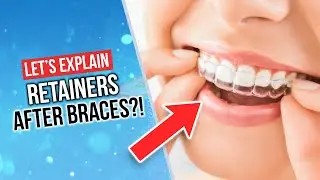 NO RETAINER After Braces?!