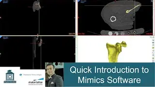 A quick introduction to mimics software for beginners