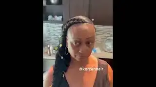 How traction alopecia starts