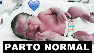 RELATO DE PARTO 👶🏻 | PELO SUS
