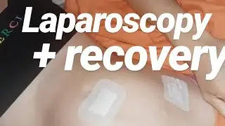 Laparoscopy  + Real RECOVERY uk