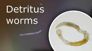 Detritus Worms: What Is It and How to Get Rid of Them. Detritus Worms Under a Microscope