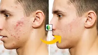 Remove image spots with Snapseed  | Restore pimples face using Snapseed