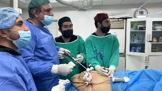 Dr Muhammad Naeem Taj doing a challenging  case of Sleeve Gastrectomy