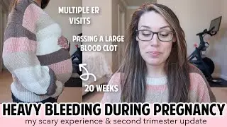 BLEEDING IN PREGNANCY - FIRST & SECOND TRIMESTER BLEEDING | SUBCHORIONIC HEMATOMA? PLACENTA PREVIA?