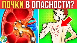 12 ТРЕВОЖНЫХ Признаков Того, Что Ваши Почки Могут Быть В ОПАСНОСТИ! ⚠️