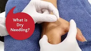 What is dry needling?