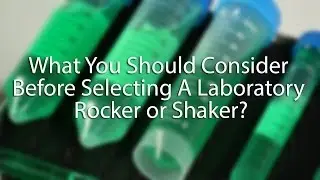 What You Should Consider Before Selecting A Laboratory Rocker or Shaker