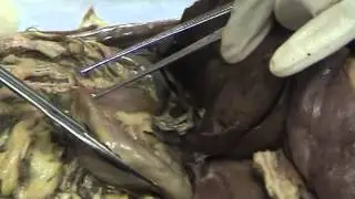 Abdominopelvic Cavity part 3