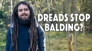 Dreads STOP Balding?