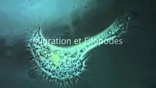 Leptophrys vorax, une amibe multiforme