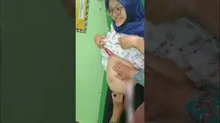 cantik cek kesehatan kehamilan berkacamata | istri idaman