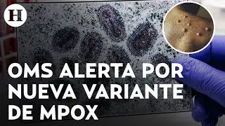 OMS recomienda uso de cubrebocas contra el Mpox; ¿cuántos casos de viruela del mono hay en México?
