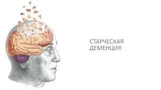 Деменция: основные симптомы, признаки и стадии развития