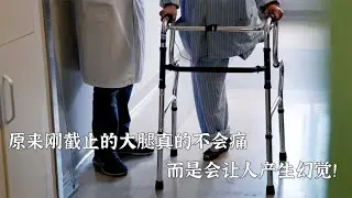 原来刚截肢的大腿真的不会痛，而是让人产生幻觉