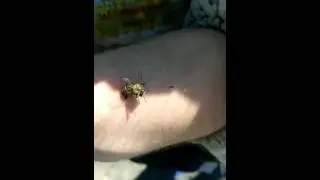 Укус пчелы