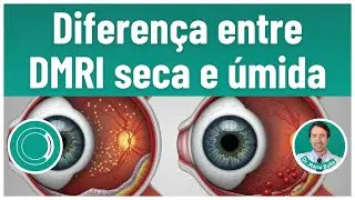 Difference between dry and wet AMD