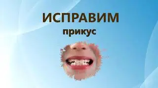 Исправляем прикус в Орто-Дент.