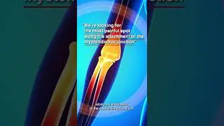 Try This Technique To help Treat Golfer’s Elbow
