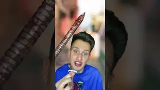 Мальчик на тупил на гвоздь и он 15 км с такой ногой😰❌