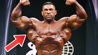Derek Lunsford Has  The Worst Arms in Bodybuiding History