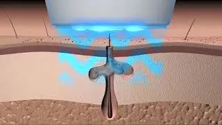 Phototherapy Blue Light Skin Cleaner Pen