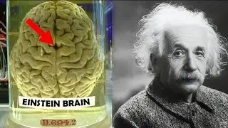 How Einstein's Brain was Different #facts