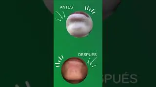 CREMA PARA VITÍLIGO DERMAOIL