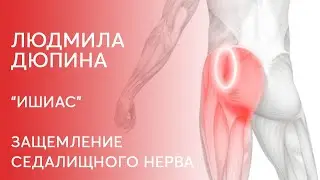 Защемление седалищного нерва или Ишиас. Что делать? Как снять воспаление?
