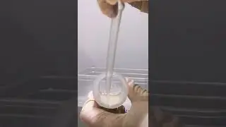 Semen analysis 