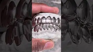 My SILVER GRILLZ (who made them?)