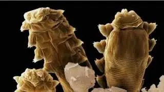 Viviendo en nuestro rostro: Demodex folliculorum.