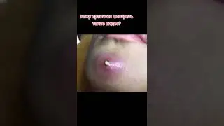 Самое залипательное видео давить прыщи Черные точки