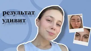 не делай ЛАМИНИРОВАНИЕ БРОВЕЙ, если у тебя есть ЭТИ ПРОТИВОПОКАЗАНИЯ
