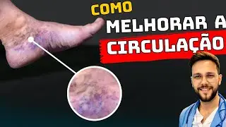 HOW TO INSTANTLY IMPROVE THE CIRCULATION OF SWOLLEN LEGS AND FEET
