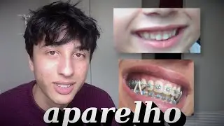 Eu tirei o aparelho
