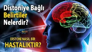 Distoni Nasıl Bir Hastalıktır? Distoniye Bağlı Belirtiler Nelerdir?