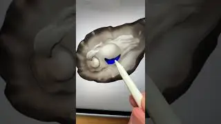 🦪🔪 Oyster Emoji 