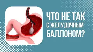 Желудочный баллон опасен?