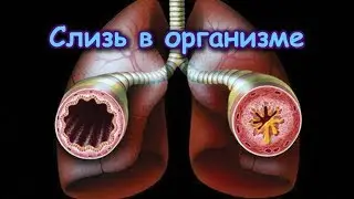 СЛИЗЬ В ОРГАНИЗМЕ. Откуда берётся, чем опасна и как выводить?