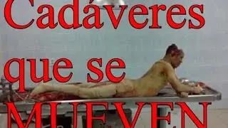 El Rigor Mortis - Despertó en Autopsia - CAPTADO EN CÁMARA.