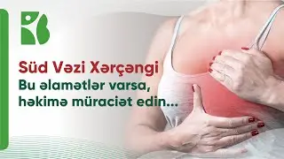 Süd vəzi xərçəngi | Səssiz qatil: Xərçəng xəstəliyi əsrin bəlası olsa da, onun qarşısını almaq olar!