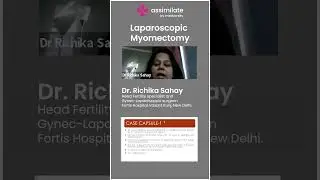 Laparoscopic Myomectomy | Medical Case Discussion | Assimilate by Medvarsity