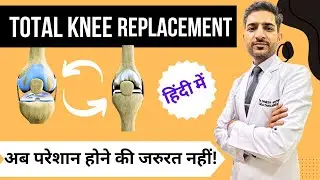 घुटना बदलवाने की सर्जरी  ( Total Knee replacement in Hindi ) घुटना बदलवाने की सर्जरी( 3D Animation )