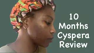 Cyspera Before And After 10 Months Review Answering Questions