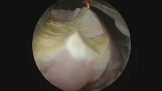Sheep kidney TURP Model